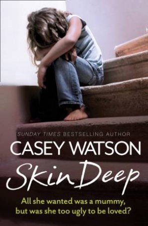 Skin Deep by Casey Watson