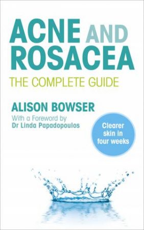 Acne And Rosacea by Alison Bowser