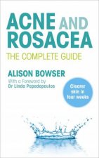 Acne And Rosacea