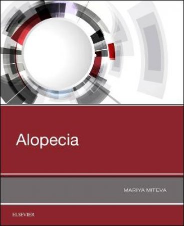 Alopecia by Mariya I. Miteva