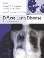 Diffuse Lung Disease A Practical Approach