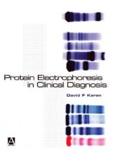 Protein Electrophoresis In Clinical Diagnosis