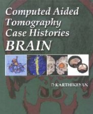 Computer Aided Tomography Case Histories Of The Brain