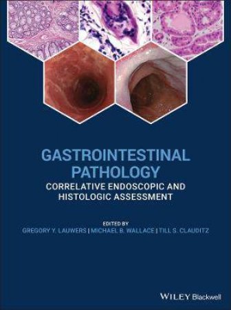 Gastrointestinal Pathology by Gregory Y. Lauwers & Michael B. Wallace & Till S. Clauditz