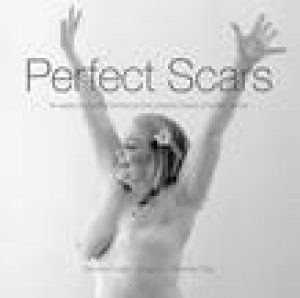 Perfect Scars by Beverley, Lacina, Jill & Paul, Rosemary Corlett