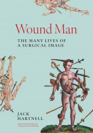 Wound Man by Jack Hartnell