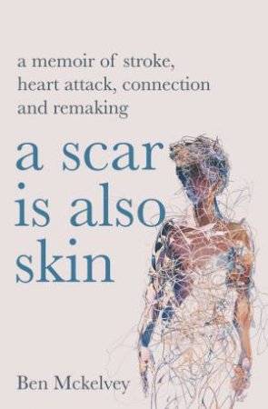 A Scar Is Also Skin by Ben Mckelvey