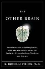 Other Brain