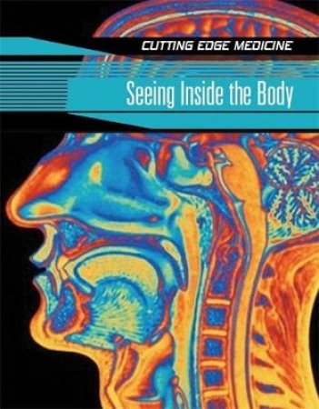 Cutting Edge Medicine: Seeing Inside The Body by Carol Ballard