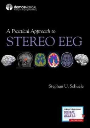 A Practical Approach To Stereo EEG by Stephan U. Schuele