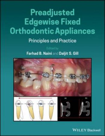 Preadjusted Edgewise Fixed Orthodontic Appliances by Farhad B. Naini & Daljit S. Gill