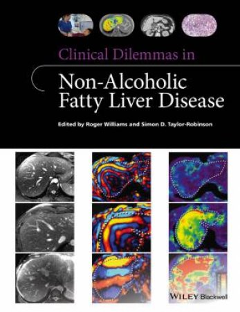 Clinical Dilemmas In Non-alcoholic Fatty Liver Disease by Roger Williams & Simon D. Taylor-Robinson