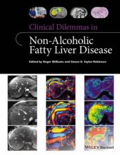 Clinical Dilemmas In Nonalcoholic Fatty Liver Disease
