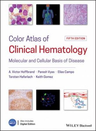 Color Atlas Of Clinical Hematology: Molecular Andcellular Basis Of Disease by Various