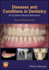 Diseases And Conditions In Dentistry An EvidenceBased Reference