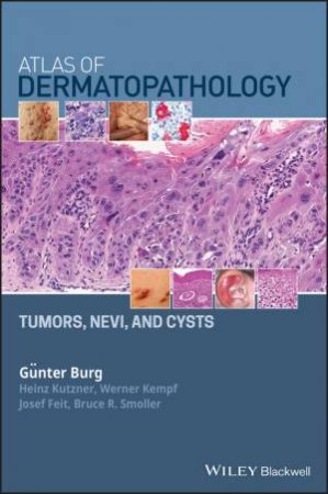 Atlas Of Dermatopathology Tumors, Nevi, And Cysts by Various