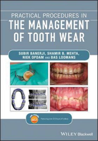 Practical Procedures In The Management oO Tooth Wear by Subir Banerji & Shamir B. Mehta & Niek Opdam & Bas Loomans