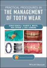 Practical Procedures In The Management oO Tooth Wear