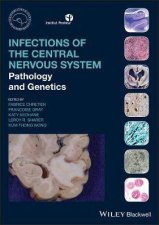 Infections Of The Central Nervous System