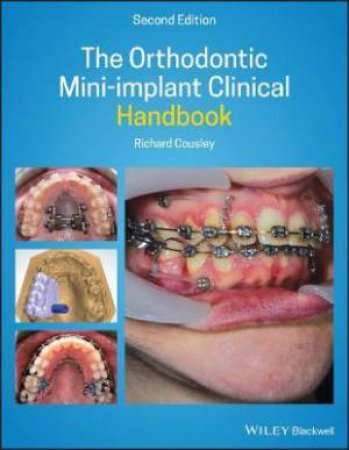 The Orthodontic Mini-implant Clinical Handbook by Richard Cousley
