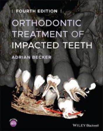 Orthodontic Treatment Of Impacted Teeth by Adrian Becker