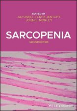 Sarcopenia