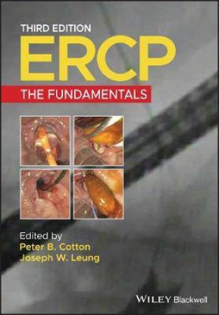 ERCP by Peter B. Cotton & Joseph W. Leung
