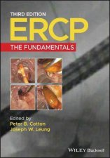 ERCP