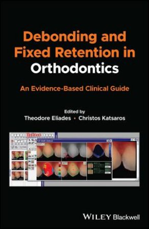 Debonding and Fixed Retention in Orthodontics by Theodore Eliades & Christos Katsaros