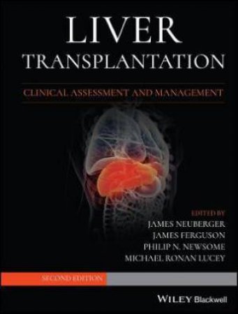 Liver Transplantation by James Neuberger & James Ferguson & Philip N. Newsome & Michael R. Lucey