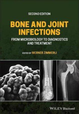 Bone And Joint Infections by Werner Zimmerli