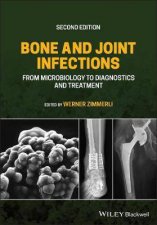 Bone And Joint Infections