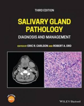 Salivary Gland Pathology by Eric R. Carlson & Robert A. Ord