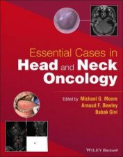 Essential Cases In Head And Neck Oncology