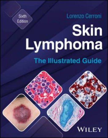 Skin Lymphoma by Lorenzo Cerroni