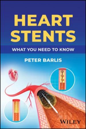 Heart Stents by Peter Barlis