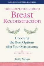 The Complete Guide to Breast Reconstruction 5e
