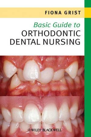 Basic Guide to Orthodontic Dental Nursing by Fiona Grist