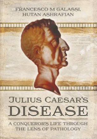 Julius Caesar's Disease by SHRAFIAN / GALASSI