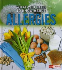 What You Need To Know About Allergies