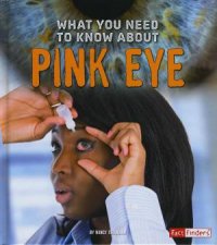 What You Need To Know About Pink Eye