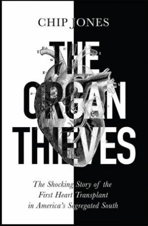 The Organ Thieves by Chip Jones