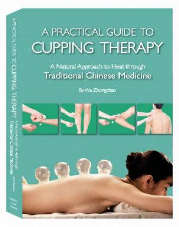 A Practical Guide To Cupping Therapy by Wu Zhongchao