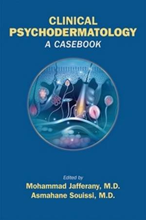 Clinical Psychodermatology by Mohammad Jafferany & Asmahane Souissi