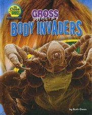 Up Close and Gross Gross Body Invaders