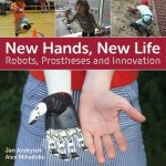 New Hands New Life Robots Prostheses And Innovation