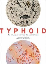 Typhoid The Past Present And Future Of An Ancient Disease