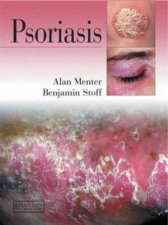 Psoriasis HC