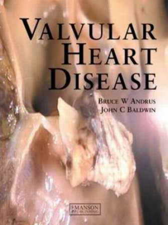 Valvular Heart Disease by Bruce W. et al Andrus