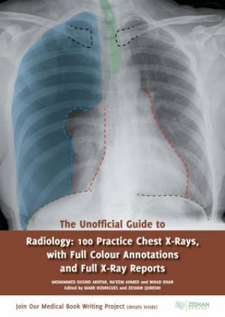 The Unofficial Guide to Radiology by Nihad Khan & Rashid Akhtar & Na'eem Ahmed & Mark Rodrigues & Zeshan Qureshi